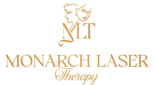 Monarch Laser Therapy Logo